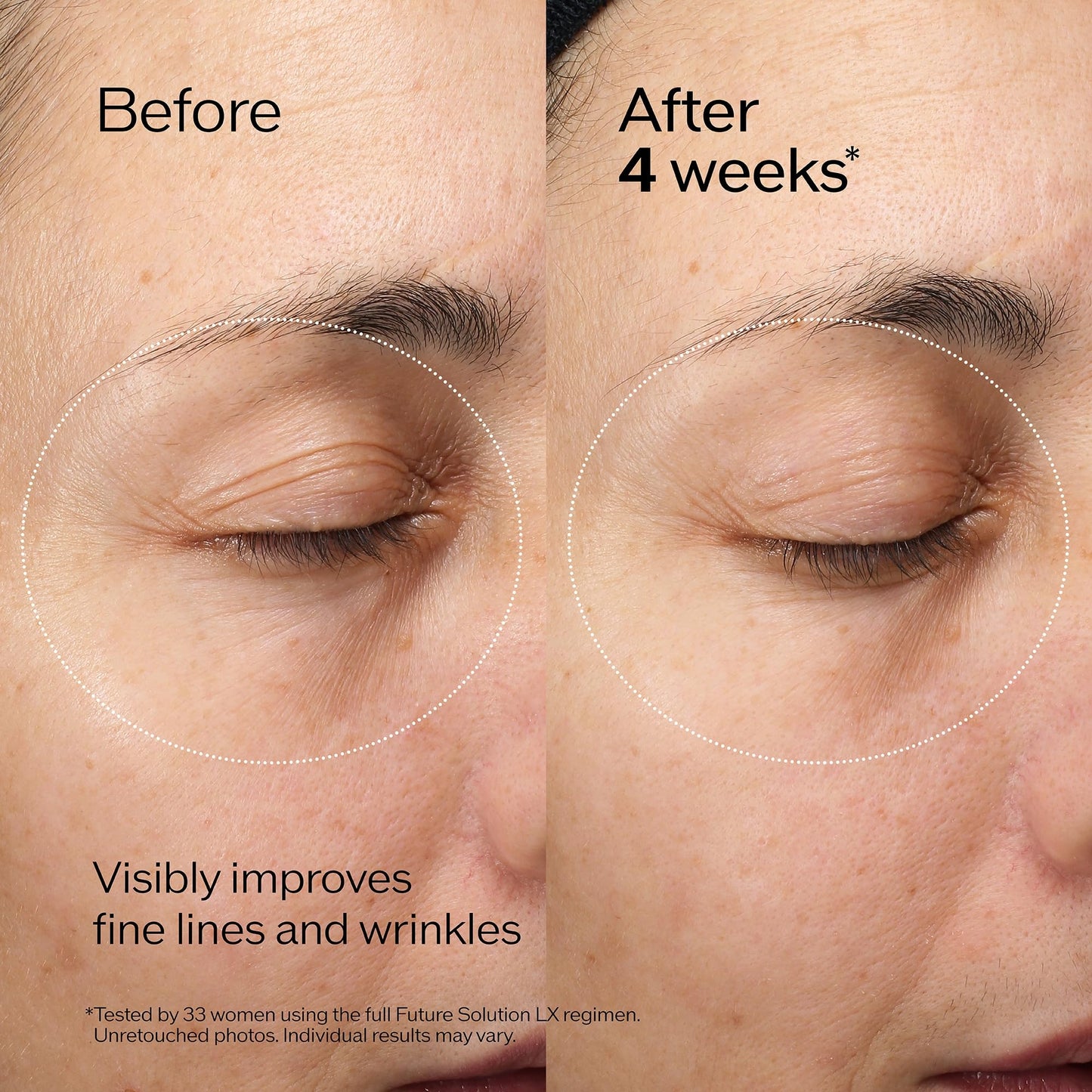 Shiseido Future Solution LX Eye and Lip Contour Regenerating Cream - 17 mL - Visibly Improves the Look of Wrinkles & Sagging Around the Eyes and Mouth - All Skin Types