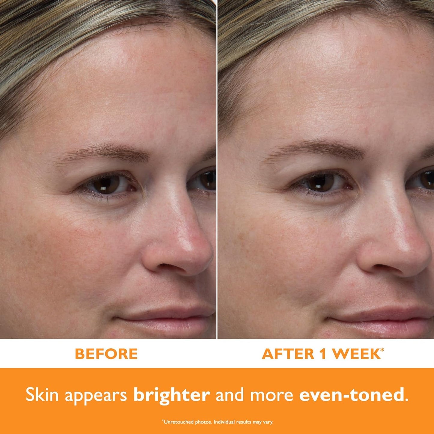 Potent-C™ Power Serum - Brightening Vitamin C Skincare for Radiant Skin | 1 oz