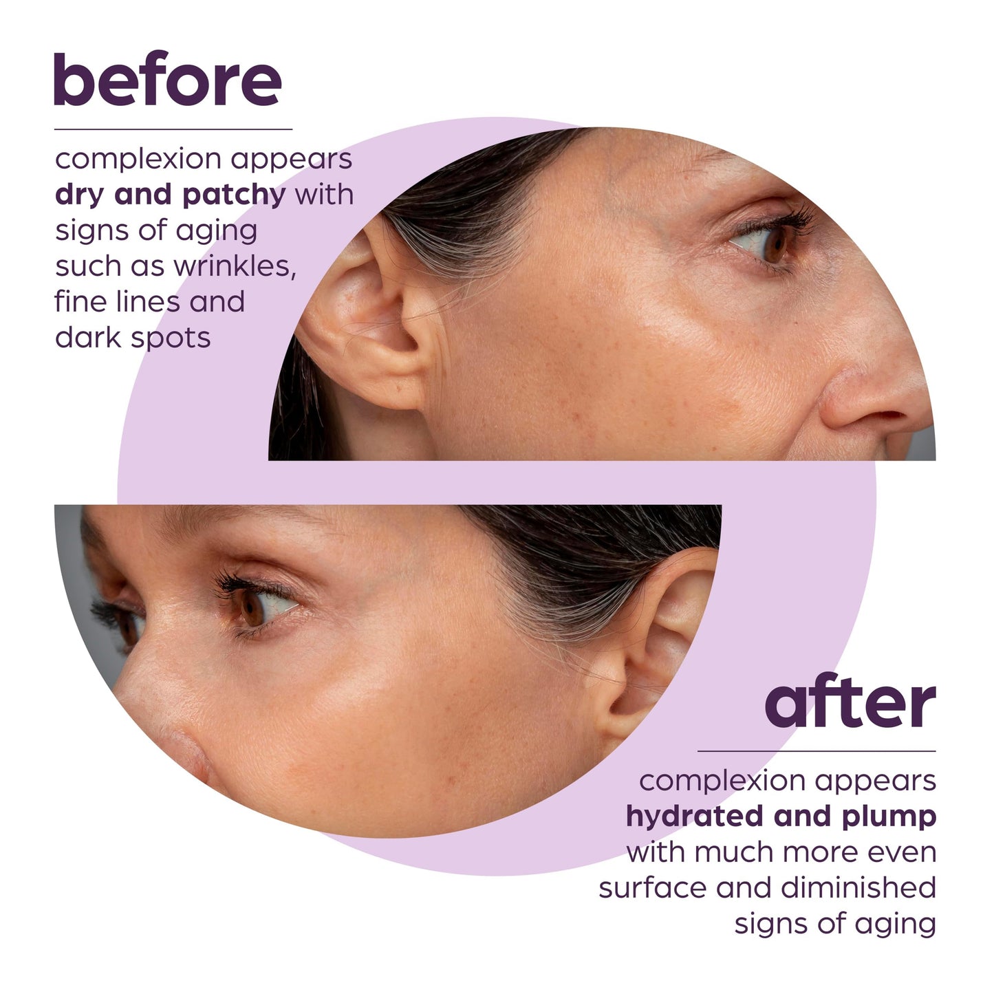 50% Beta Glucan Anti-Aging, Plumping Serum (1.01 Fl Oz (Pack of 2), 2pcs)