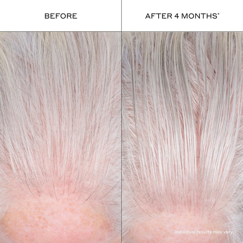ZENAGEN Densifying Hair Serum for Fine + Thinning Hair | Boosts Hair Density, Strengthens & Nourishes Hair Follicles, Non-Greasy Water-Based Formula, Plant-Based, Vegan, All Hair Types, 1 oz