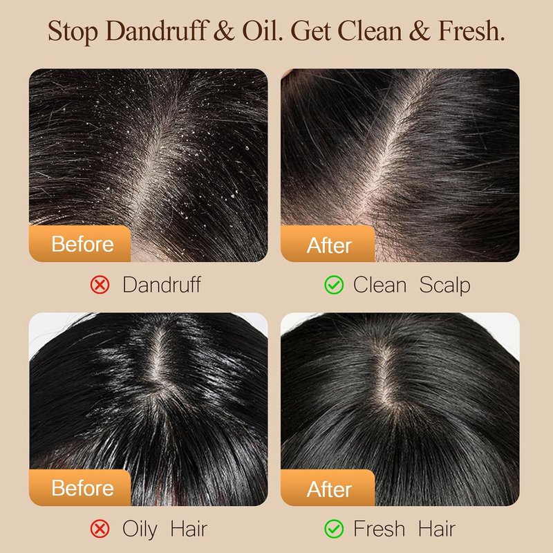 Sulfate-Free Anti-Dandruff Shampoo & Conditioner Set - Argan Oil Treatment for Oily, Dry, & Curly Hair | 27 Oz