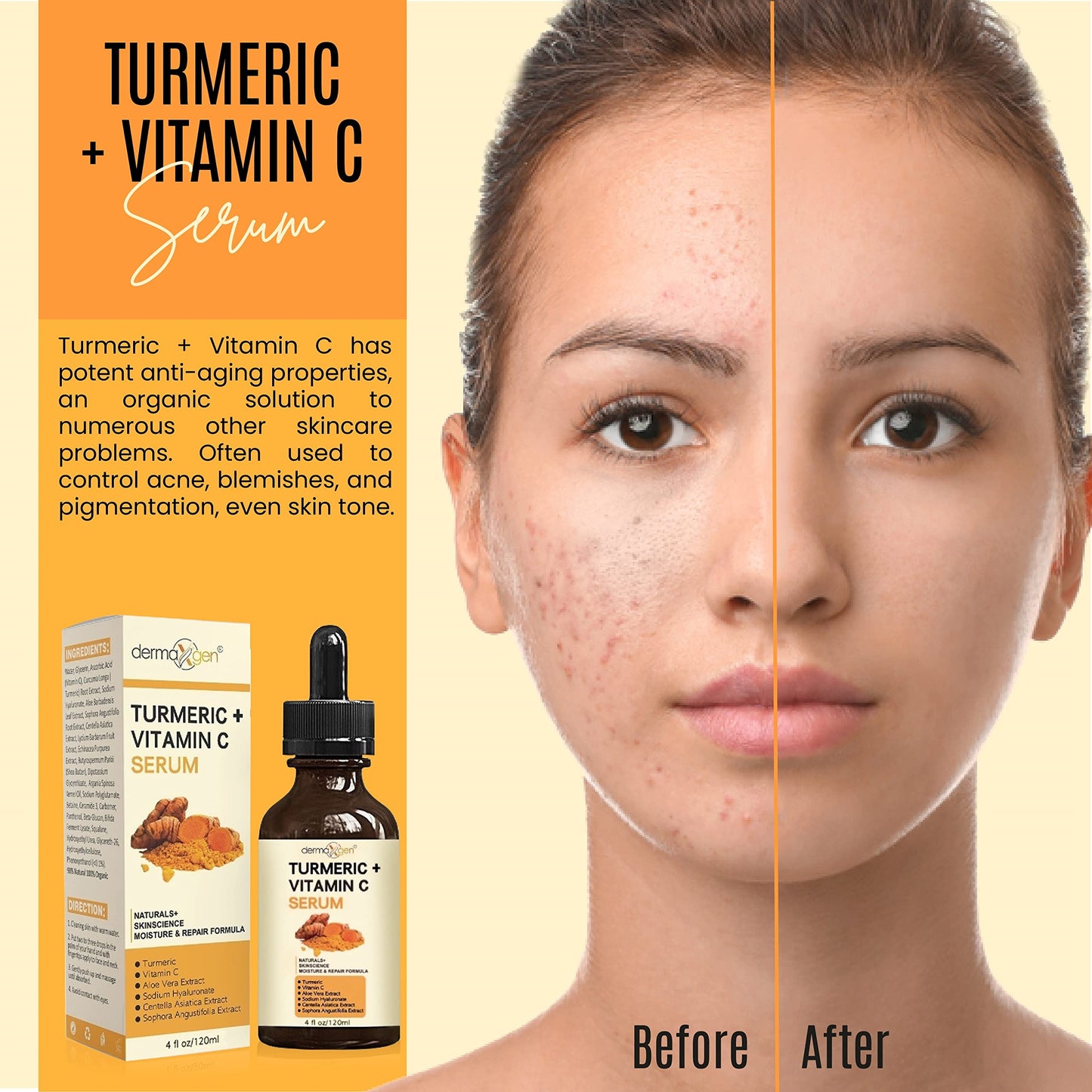 Turmeric Serum for Face + Glow-Boosting Vitamin C Serum –Organic Moisturizer for Acne, Dark Spots & Clear Skin– Boosts Hydration for Dry & Tired Skin – Anti-Aging Formula for Glowing Skin, 4 FL OZ