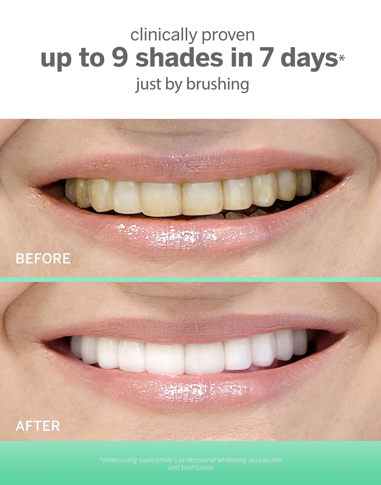Supersmile Extra White Large & Small System with 2 Toothbrushes