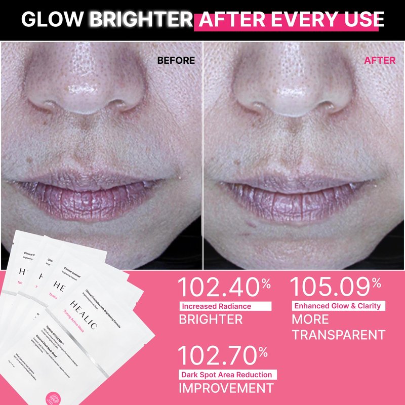 HEALIC Toning Active Mask – Brightening, Hydrating&Soothing Face Mask with Tranexamic Acid & Hyaluronic Acid, Sheet Mask with Coconut Fiber, Gentle for Sensitive Skin, Korean Skin Care, Vegan, 5EA
