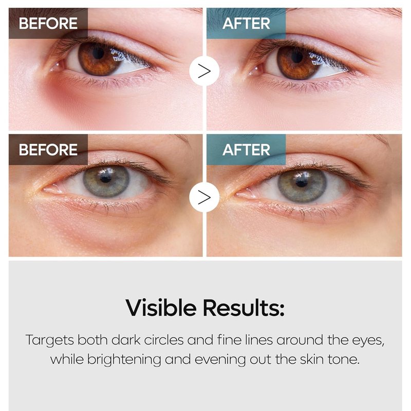 Tranexamic Acid Eye Cream - Dual Action Dark Circle Repair with Adenosine & Niacinamide | 50ml - Korean Skincare