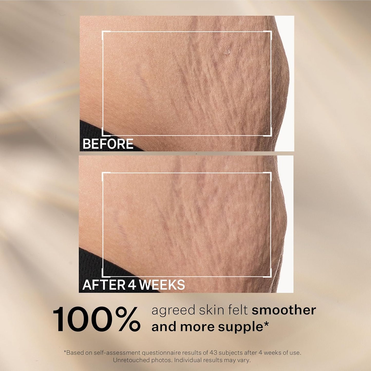 StriVectin SD Advanced Plus - Intensive Moisturizer for Wrinkles & Stretch Marks | Collagen Boosting with Peptides & Hyaluronic Acid