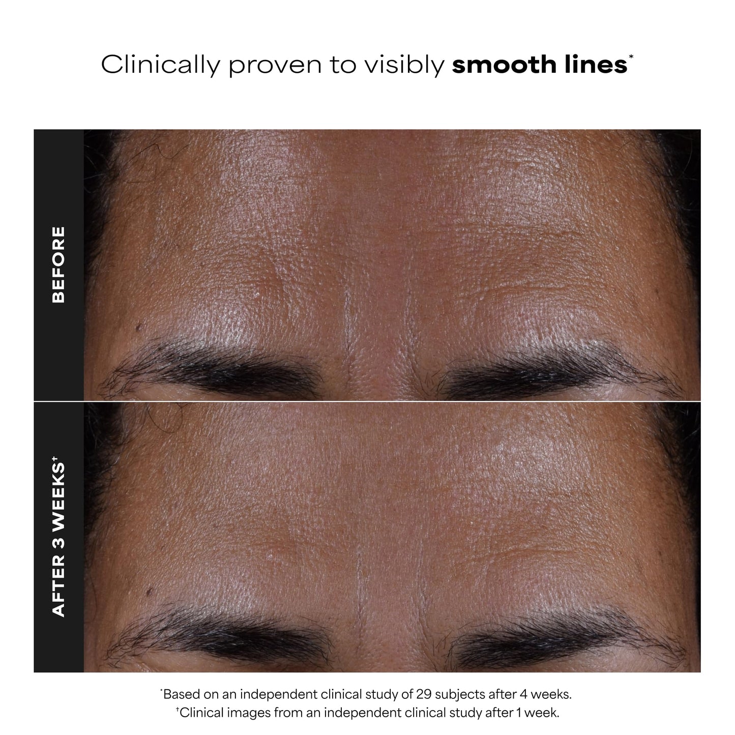 Paula's Choice SKIN PERFECTING 2% BHA Salicylic Acid Exfoliating Pads - Facial Exfoliant Pads for Blackheads, Enlarged Pores, Wrinkles & Fine Lines