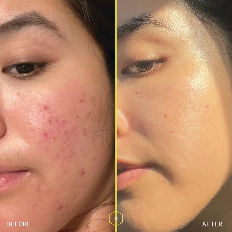1% Retinol Peptide Boosting Serum for Face - Reduces Wrinkles, Discoloration & Loss of Firmness - With Collagen Peptides & Patented Delivery System - 30ml