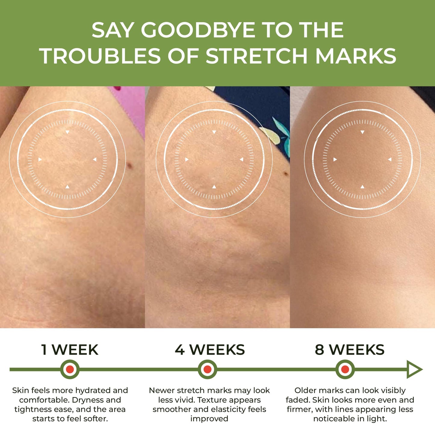 Abera Ovela Maternity Stretch Mark Cream for Pregnancy and Weight Fluctuations, Stretch Mark Treatment Pregnancy Must Haves, Deep Stretch Mark Removal, 1.69 fl oz