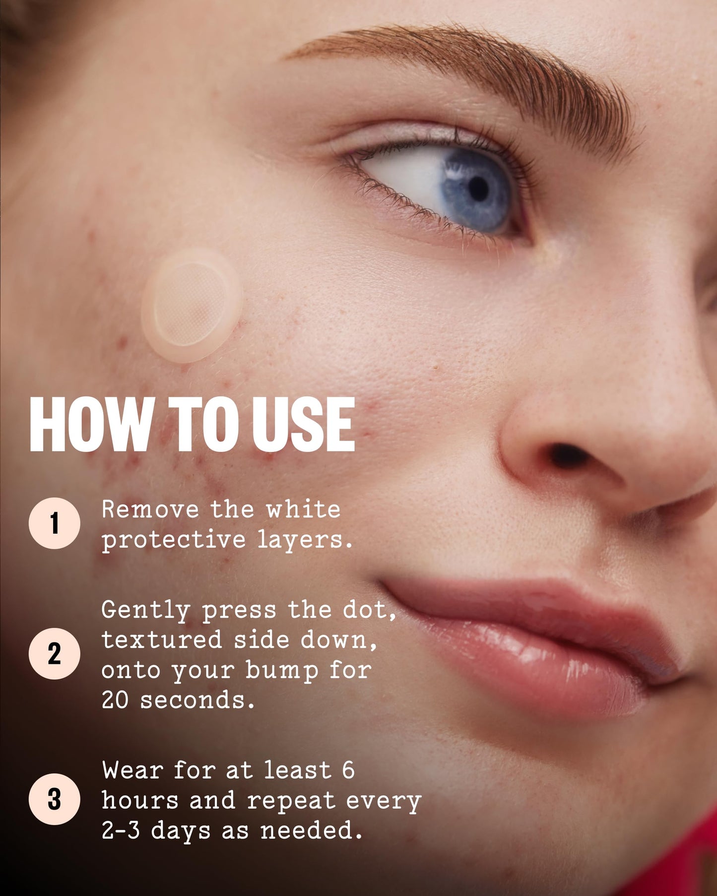 PEACE OUT Early Stage Acne Dots, Microneedling Acne Pimple Patches with 2% Salicylic Acid to Target Blemishes Forming Below the Surface (8 Count)