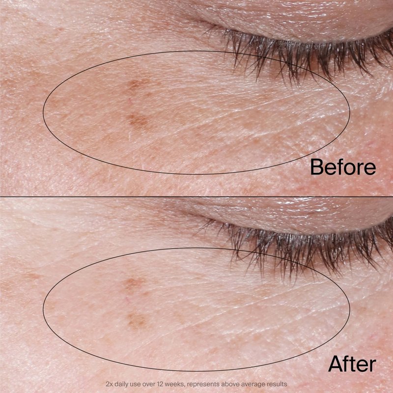 Neutrogena Collagen Bank Reviving Eye Cream, Under Eye Cream, Helps Preserve Collagen, Visibly Improves Dark Circles, Puffiness, Fine Lines, Texture, Fragrance Free, with Peptides 0.5 oz