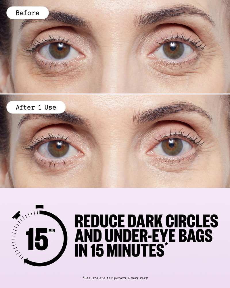 PEACE OUT Puffy Eyes Under Eye Patches, Biocellulose Mask with Caffeine, Niacinamide, and Hyaluronic Acid Tackles Puffiness, Dark Circles, Dryness (6 pairs)
