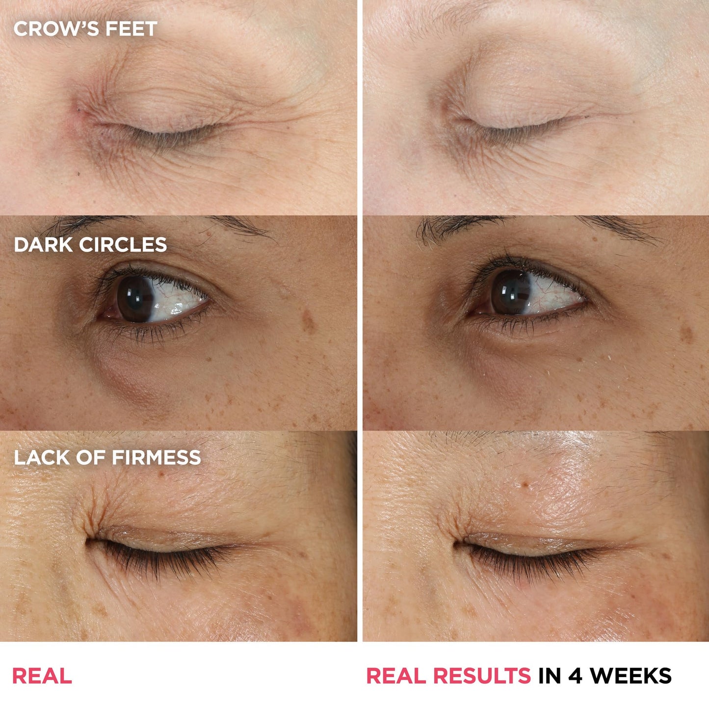 IT Cosmetics Confidence in an Eye Cream - Anti Aging Peptide Eye Cream for Dark Circles & Wrinkles, Lightweight 48HR Hydration, 2% Super Peptide Concentrate, Smooth & Brighten Undereye - 1 fl oz