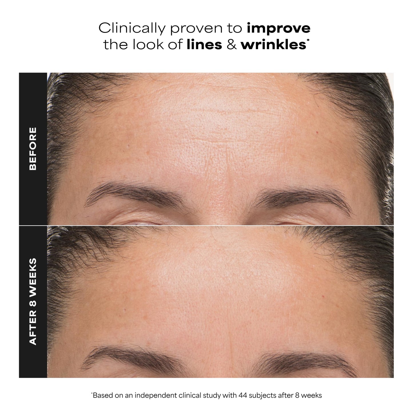 Paula's Choice 6% Mandelic + 2% Lactic Acid Liquid Exfoliant