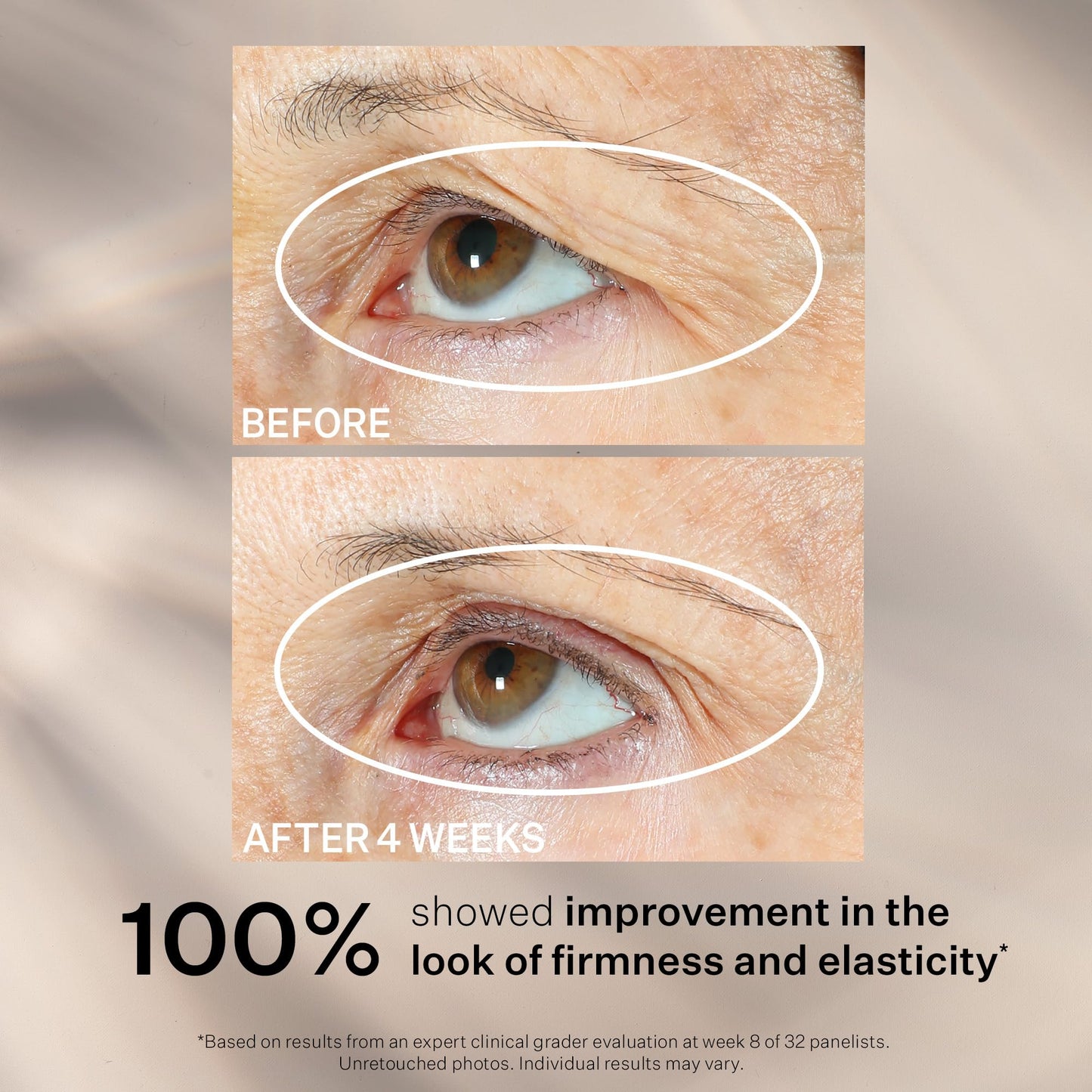 StriVectin Tighten and Lift Peptight 360 Degree Eye Serum with Tightening and Brightening Peptides for Wrinkles, Under Eye Bags and Puffiness, 1 fl. Oz