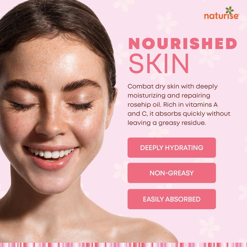 Naturise Organic Rosehip Seed Oil for Face, 100% Pure, Natural Cold Pressed Rose Hip Oil for Skin, Hair, Nails and Body Care (4 FL. OZ.)