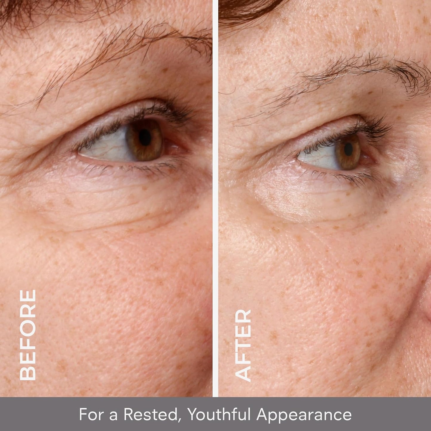 COSMEDIX Under Eye Serum - Dark Circle & Puffiness Treatment | Lifting, Firming, Hydrating Formula for Fine Lines & Wrinkles