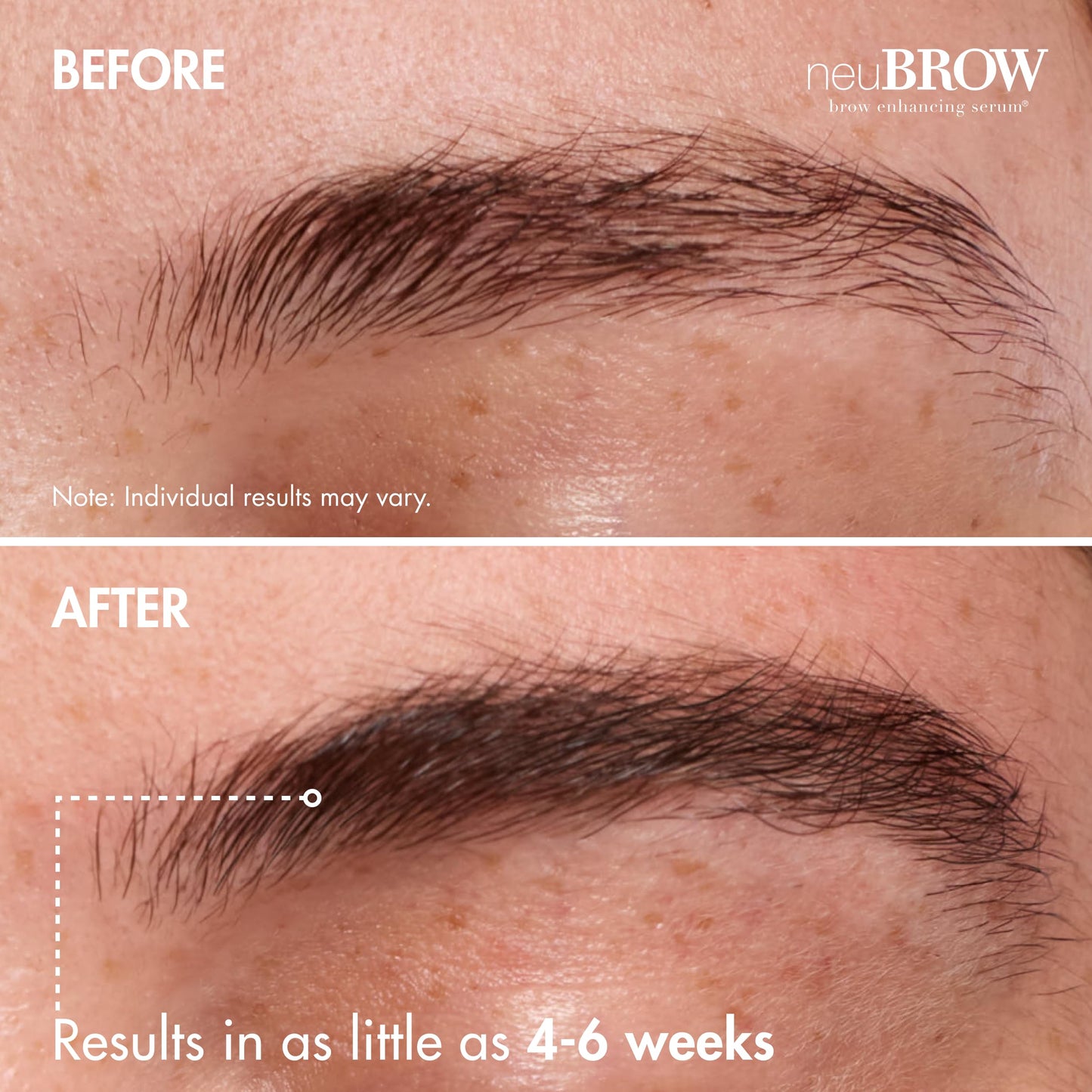 neuBROW Brow Enhancing Serum by Skin Research Laboratories - 1.5 mL Eye Brow Serum for Defined, Fuller & Thicker-Looking Hair Brows - Advanced Formula Promotes Natural & Healthy Appearance of Brows