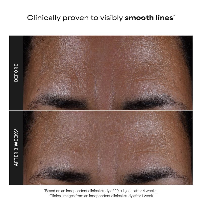 Paulas Choice--SKIN PERFECTING 2% BHA Liquid Salicylic Acid Exfoliant--Facial Exfoliant for Blackheads, Enlarged Pores, Wrinkles & Fine Lines, 4 oz Bottle