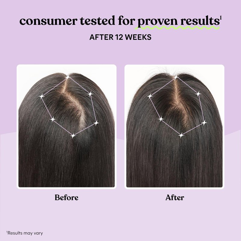 Lemme Grow Hair Growth Capsules for Women, Clinically Studied Keratin Complex, Visibly Thicker Hair & Reduced Shedding, Nourish Thinning Hair, Biotin-Free, 30 Count, 30-Day Supply