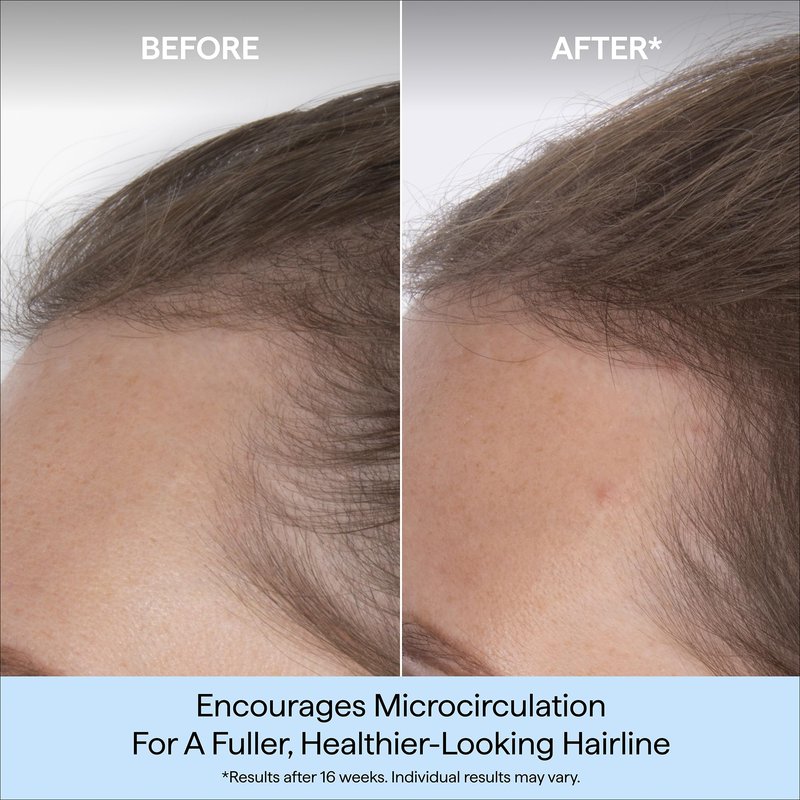 Briogeo Destined for Density Caffeine + Biotin Peptide Density Serum | Increases Hair Thickness & Volume for Fine or Thinning Hair | Fast-Absorbing & Non-Greasy | Fragrance-Free | Vegan & Cruelty-Free