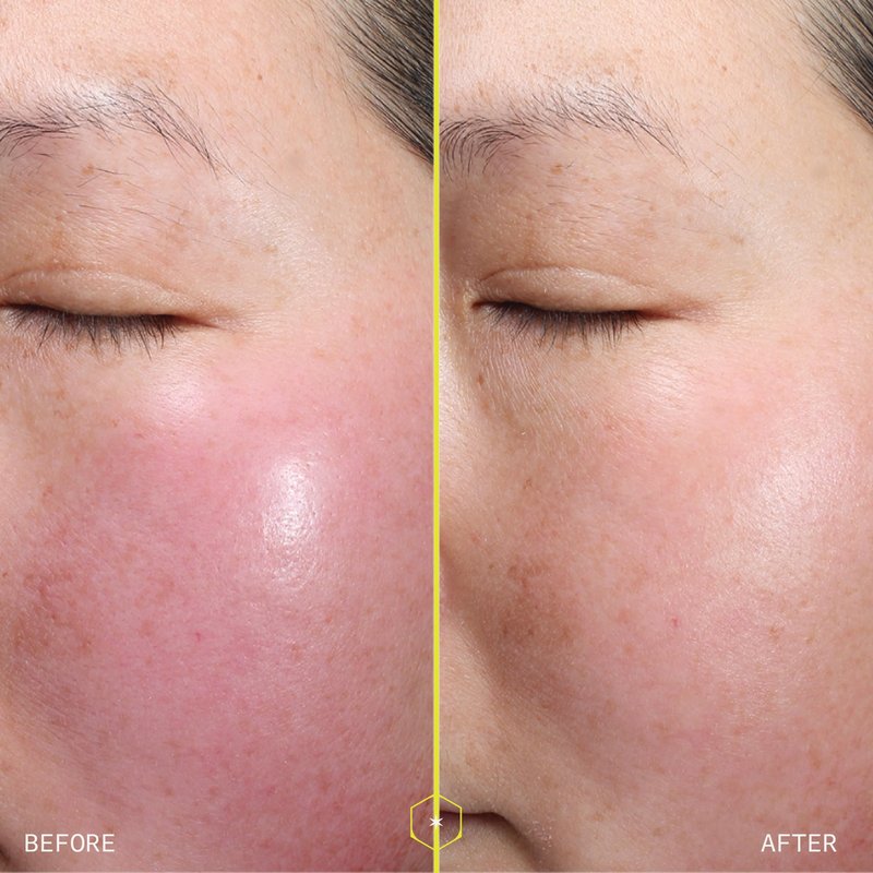 1% Retinol Peptide Boosting Serum for Face - Reduces Wrinkles, Discoloration & Loss of Firmness - With Collagen Peptides & Patented Delivery System - 30ml