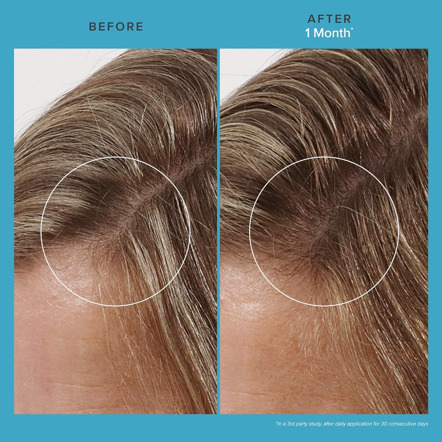 Living Proof Scalp Care Revitalizing Hair Treatment - Thicker, Fuller Hair, 2.5 Fl Oz