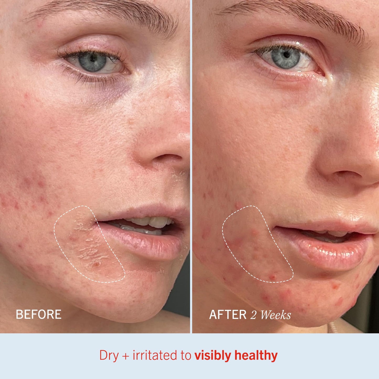 First Aid Beauty Ultra Repair Cream – Multi-Pack Options
