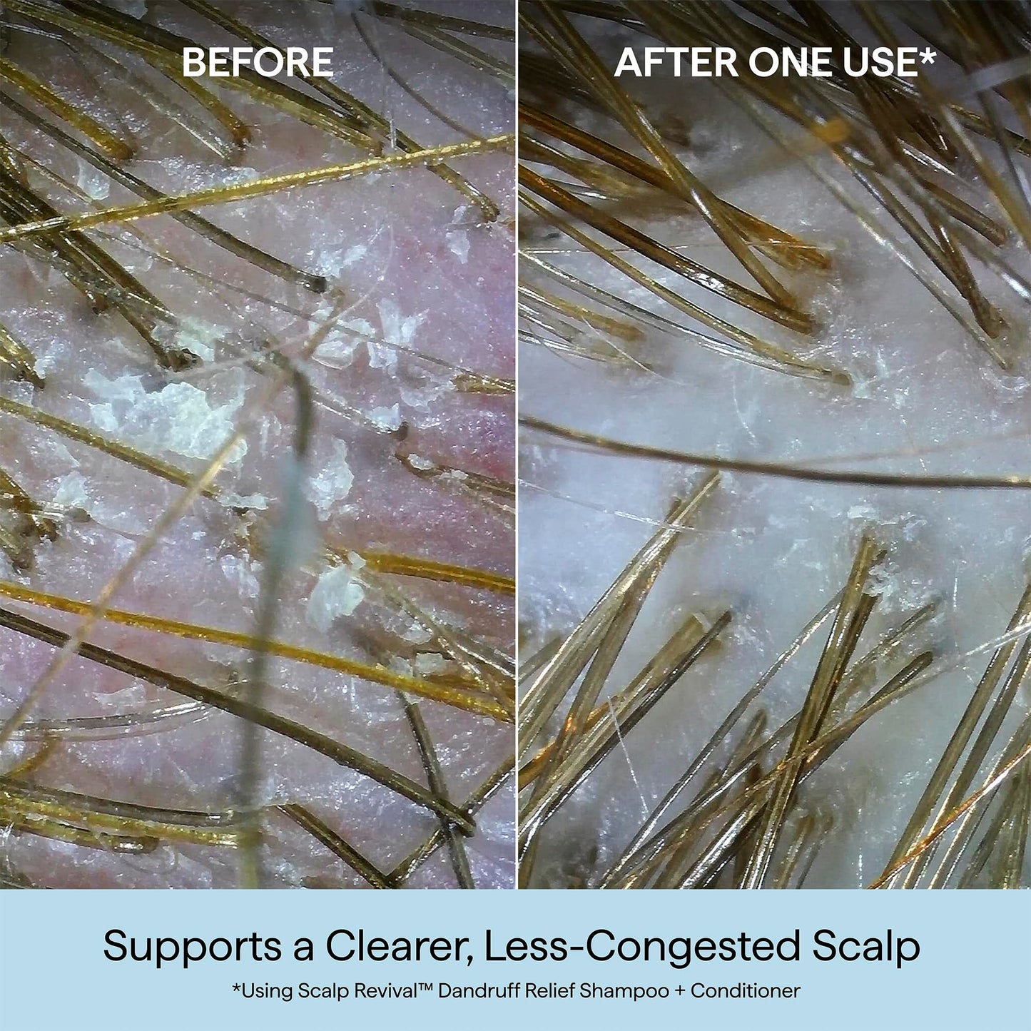 Briogeo Scalp Revival Dandruff Relief Shampoo | Charcoal + 3% Salicylic Acid | Daily Anti-Dandruff Shampoo for Flakes, Itch & Irritation | Color-Safe | Vegan & Cruelty-Free | 8.4 fl oz