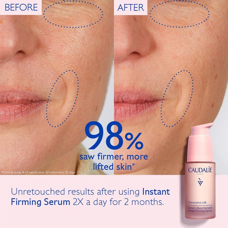 Caudalie Resveratrol-Lift Firming Serum | Retinol Alternative, Refillable - 30 mL
