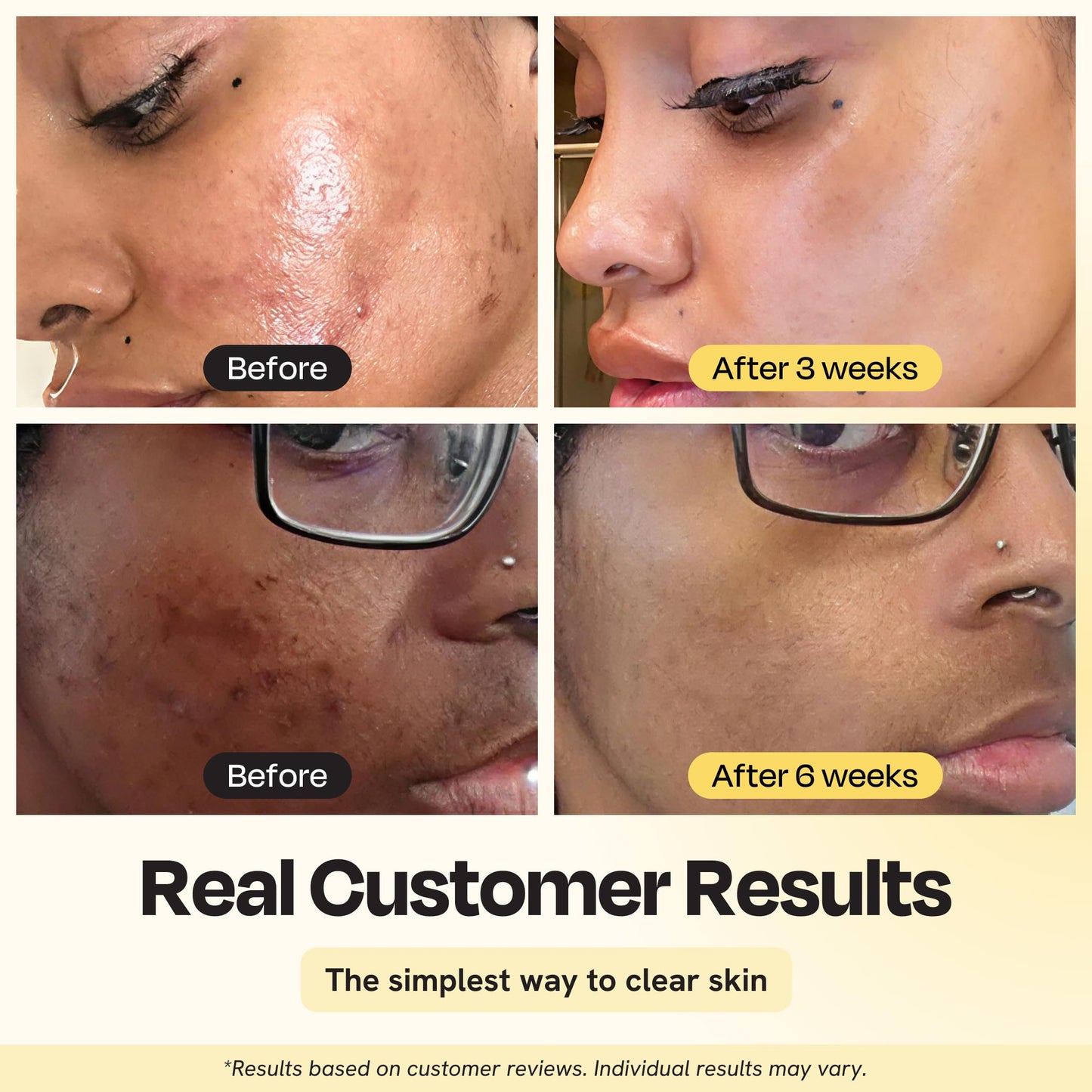 Gleamin Vitamin C Clay Mask for Dark Spots 2.5oz Brightening Clay Face Mask