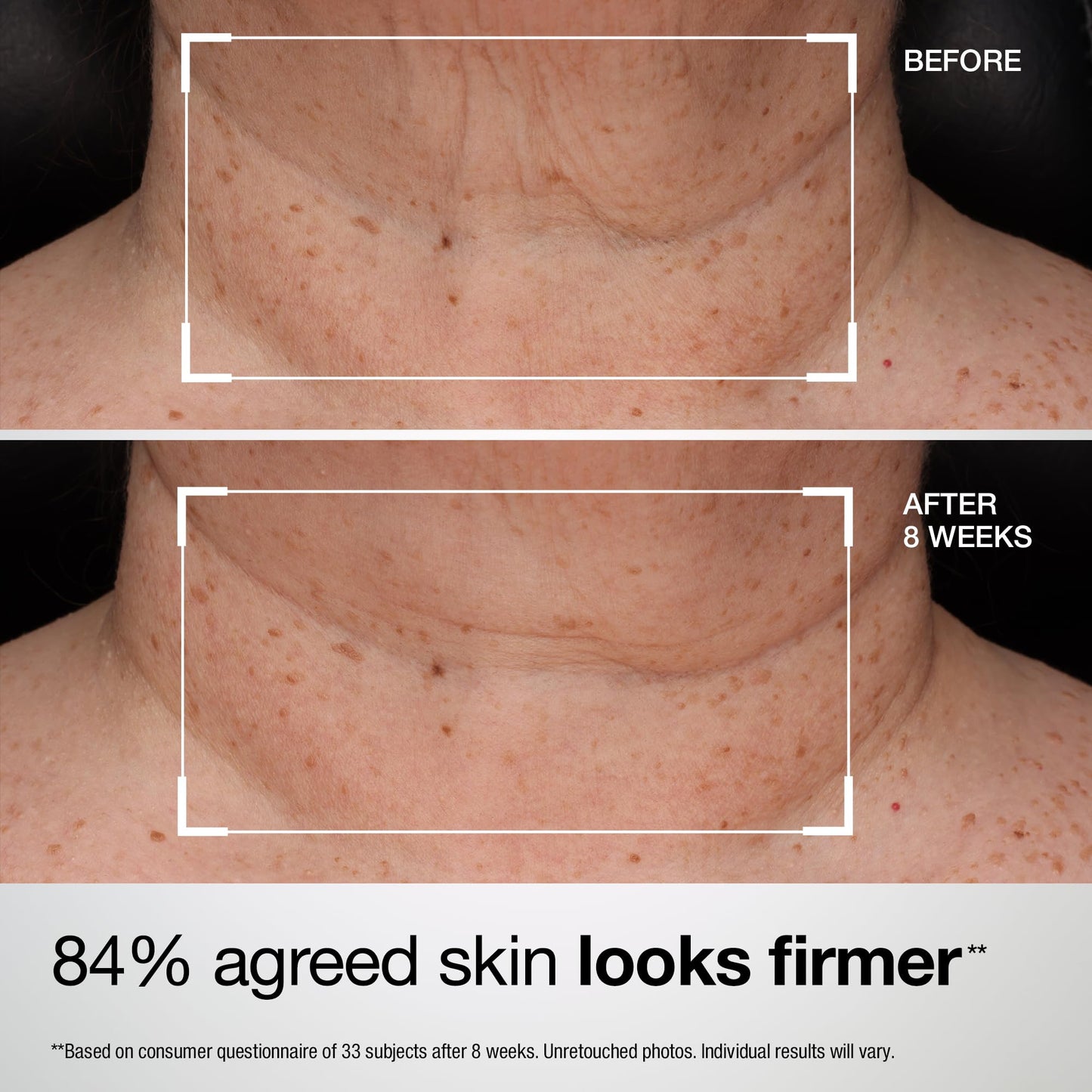 StriVectin TL Advanced Tightening Neck & Chest Lotion Broad Spectrum SPF 35 Sunscreen