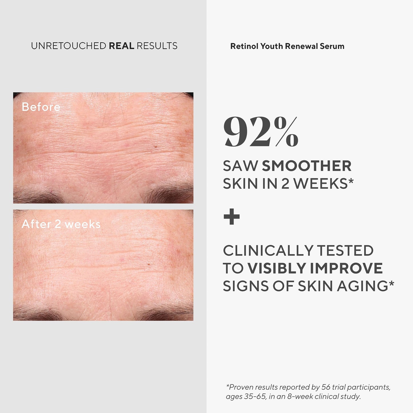 Murad Youth Renewal Retinol Trial Kit – 3-Piece Trial-Size Kit $102 Value - Anti-Aging Retinol Skincare Set - Serum for Face, Eye Serum, & Night Cream