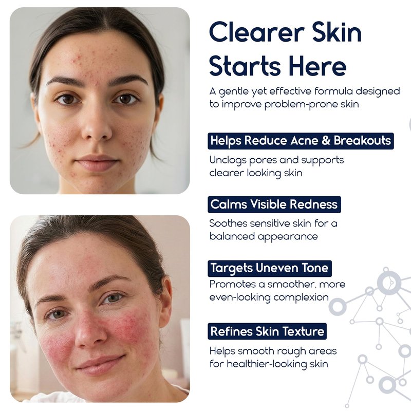 Pharmlitalia Azelaic Acid 15 Acne Cream for Face - Redness Relief, Rosacea Treatment for Face - Soothes Acne, Hyperpigmentation, Enhanced Formula for Brighter, Healthier Skin Care