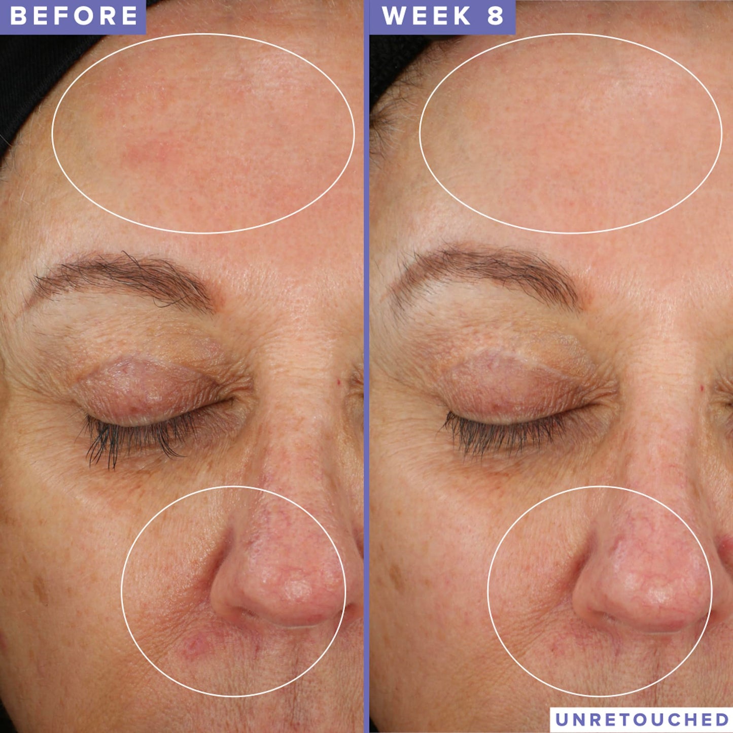 Farmacy Niacinamide Facial Mask