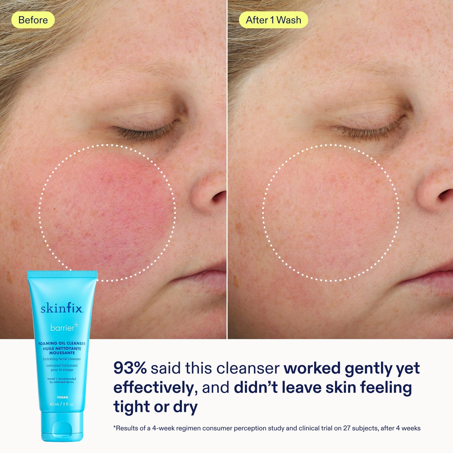 Skinfix Barrier+ Better Skin Starts Here Kit - Includes Mini Triple Lipid-Peptide Cream (0.5 oz), Mini Foaming Oil Cleanser (2 oz) & Mini Triple Lipid Activating Serum (0.35 oz) - Vegan, Cruelty Free