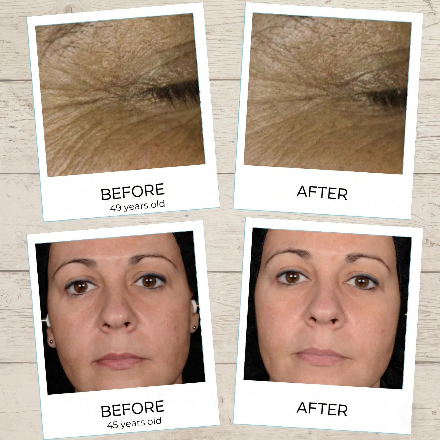 Yunasence YOGA SKIN Oxygenating Neuroactive Wellness Cream, with Antioxidants, Vitamins B. C. D. E. For Radiant, Smooth and Healthier - Looking Skin.