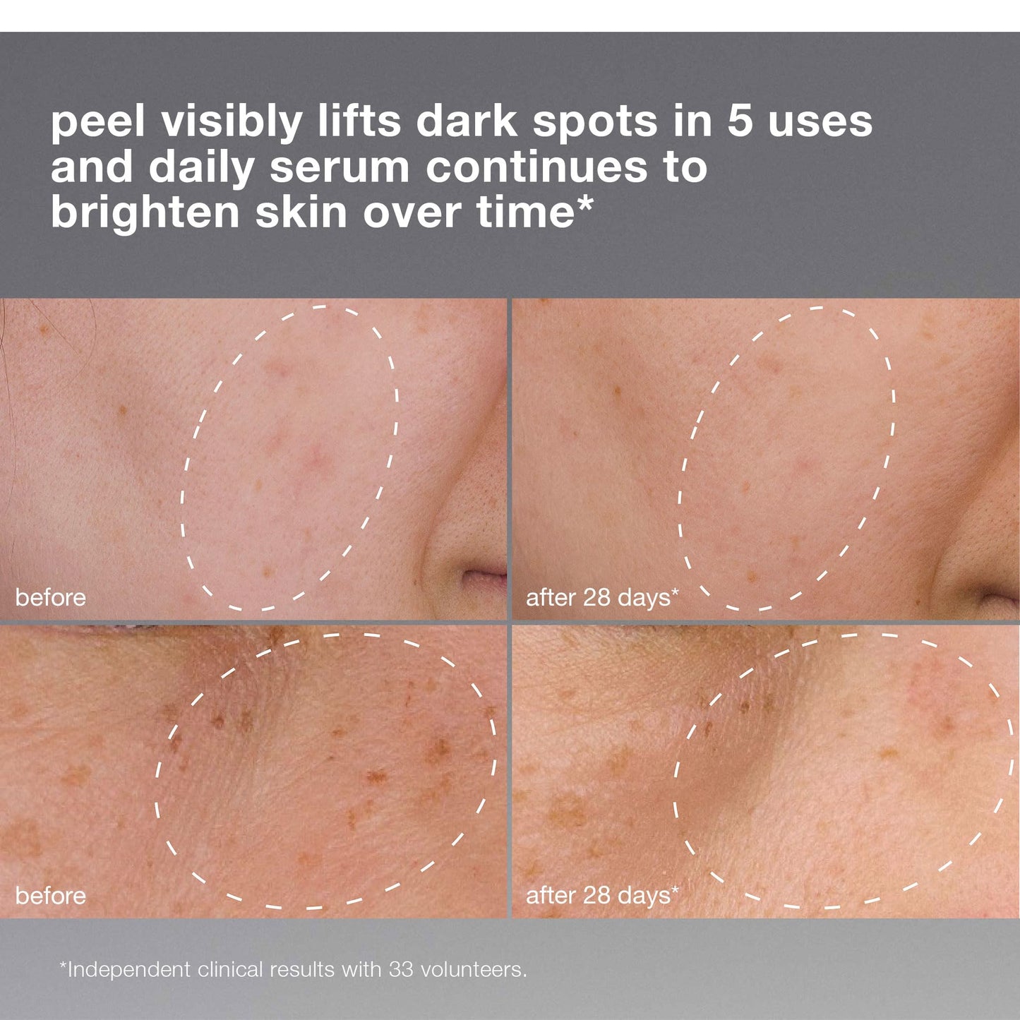 Dermalogica PowerBright Dark Spot System Skin Care Kit, Includes Face Serum and Peel - Fade, Lift, and Prevent Dark Spots and Hyperpigmentation
