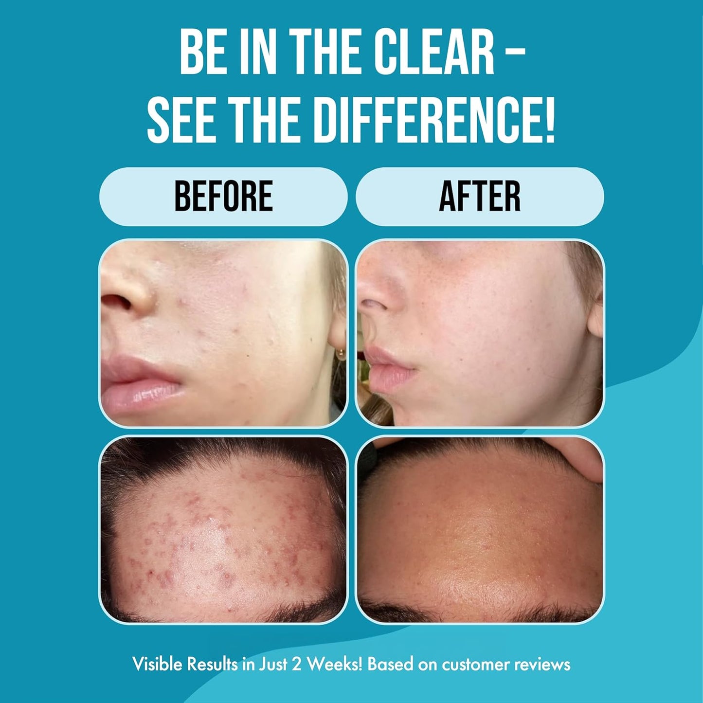 Gentle Face Cleanser for Teens - Natural Botanical Extracts for Clear Skin | 6 oz - Fresh Papaya