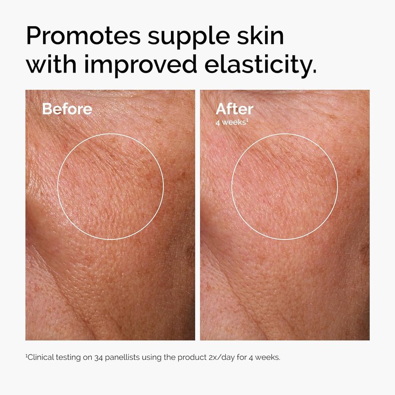 The Ordinary Serum Favorites Set | Hydrating Hyaluronic Acid, Niacinamide & Caffeine Solutions for Brightening Skin Care