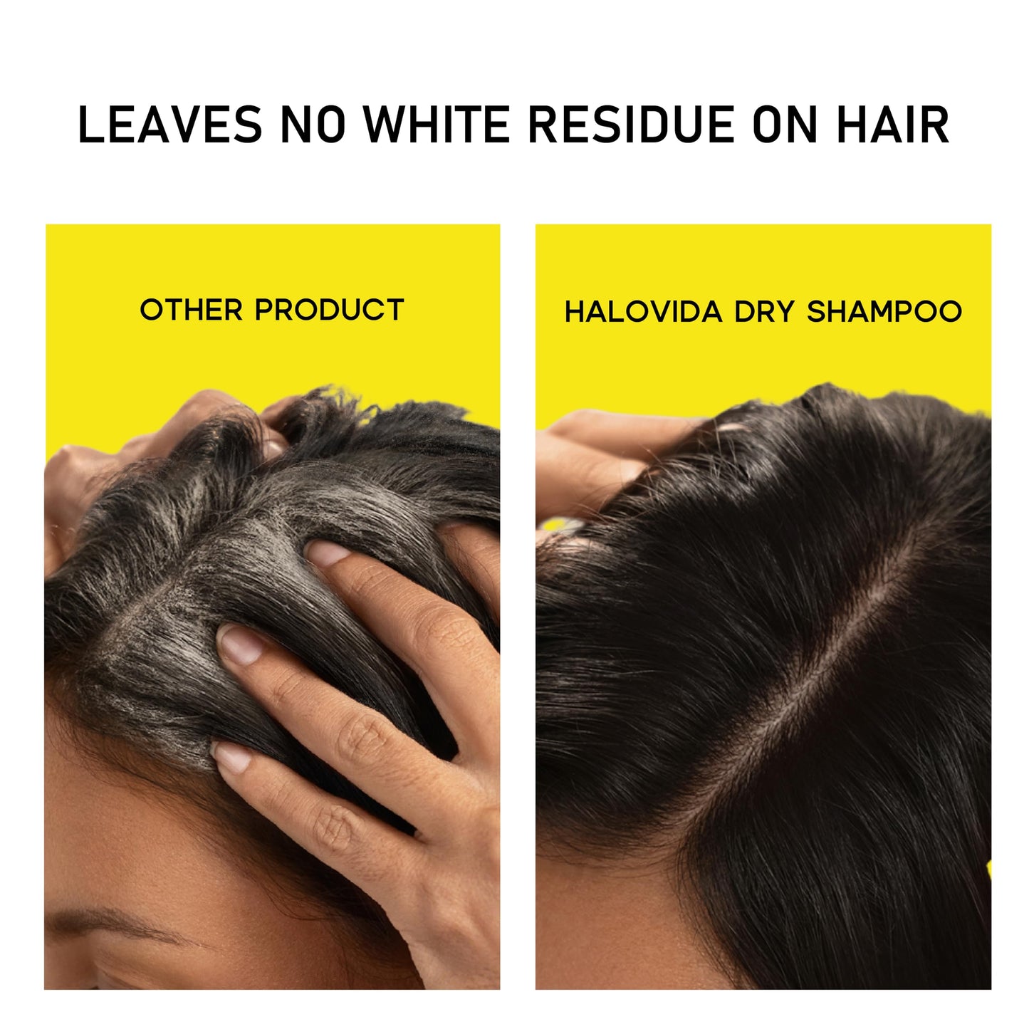 HALOVIDA Dry Shampoo for Women, Dry Scalp Shampoo Spray for Dark Hair