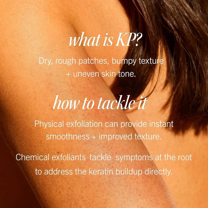 First Aid Beauty KP Bump Eraser Body Scrub - 10% AHA Exfoliator for Keratosis Pilaris | 8 oz Peach Scent