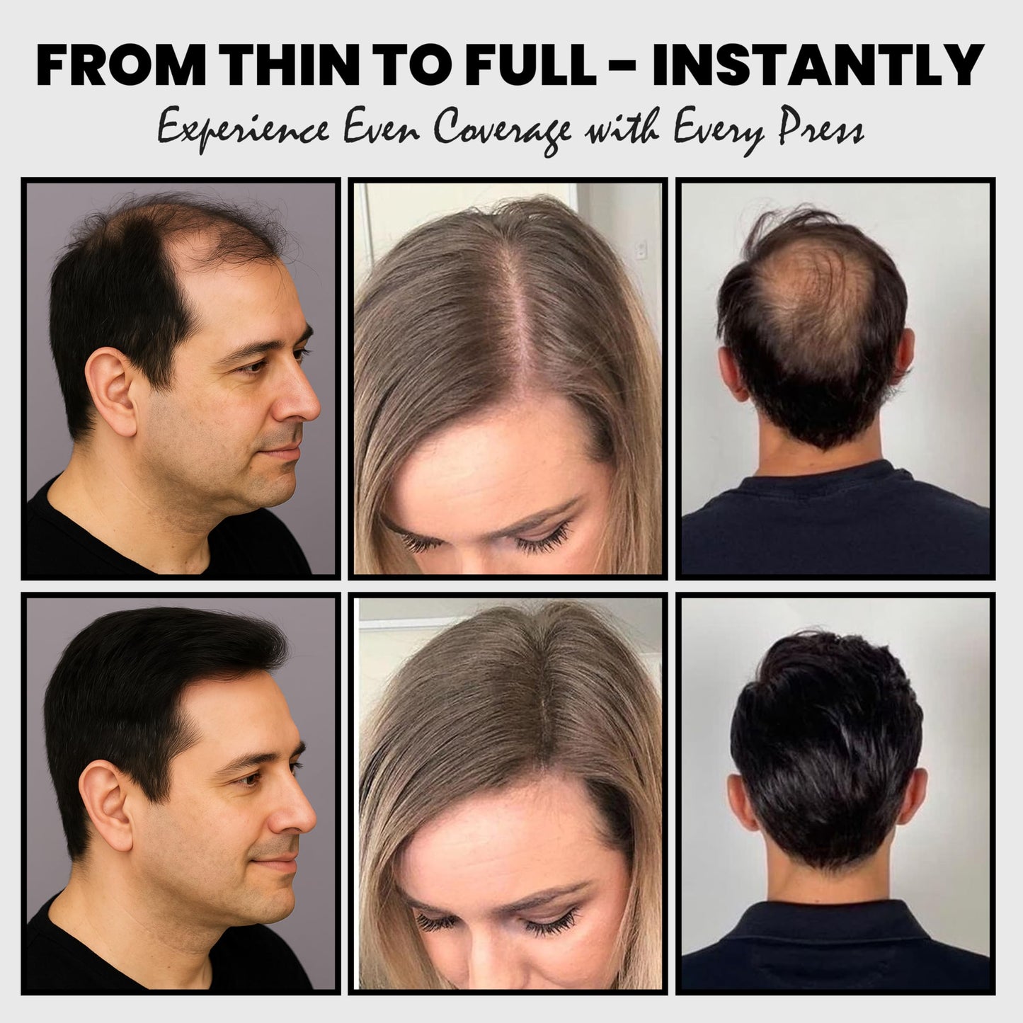 Adglamful 2PCS Hair Fibers for Thinning Hair, Hair Building Fibers Spray with Spray Applicator, Undetectable & Long-lasting, Instant Hair Coverage for Men & Women (Black, 30g*2)
