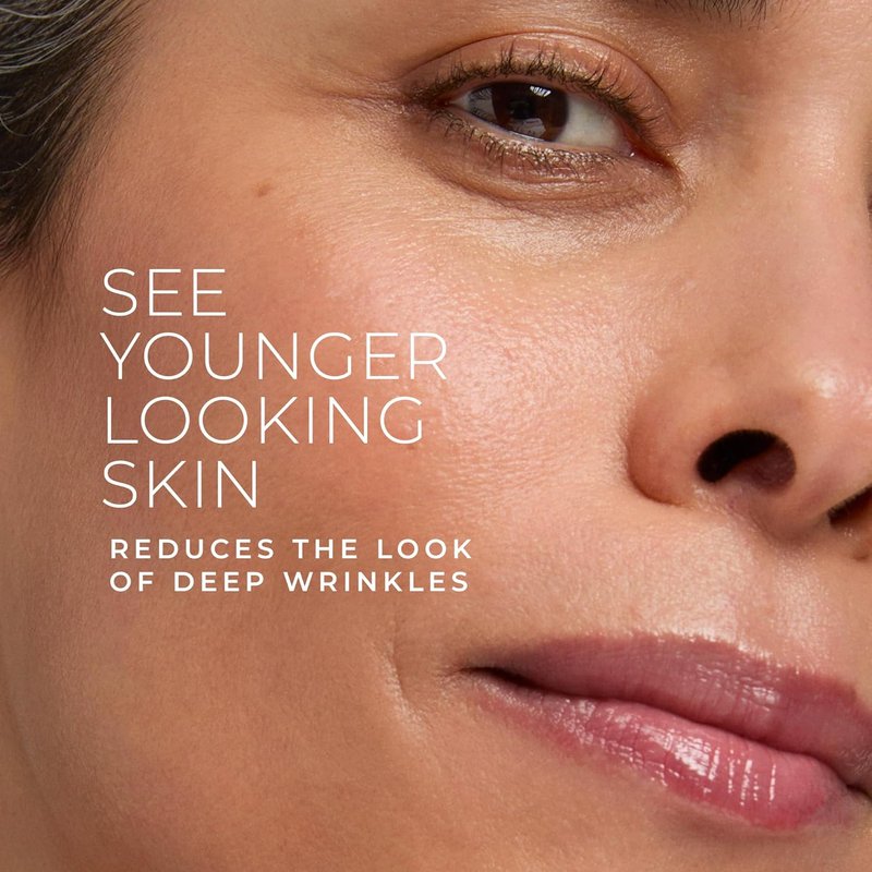 RoC Retinol Correxion Deep Wrinkle Face Serum - Anti-Aging Treatment with Ascorbic Acid | 1 Oz