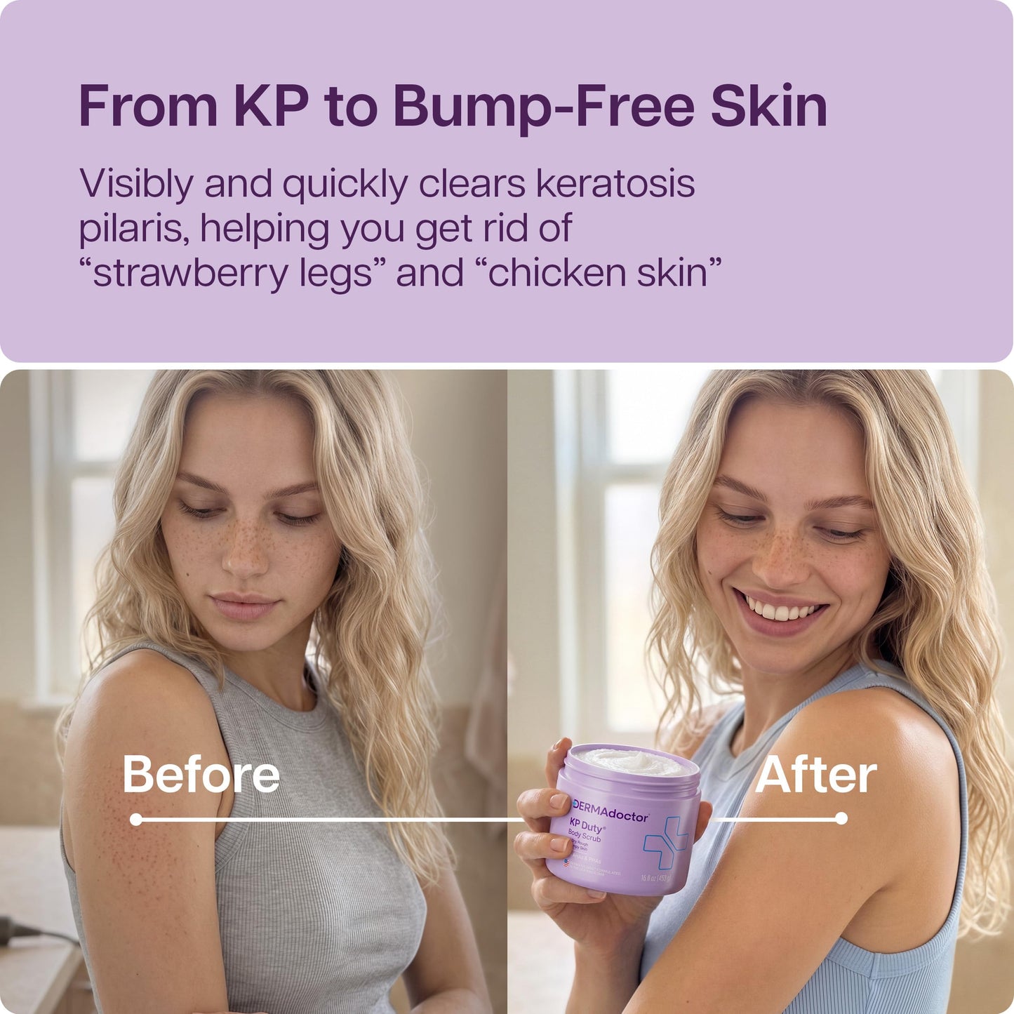 DERMAdoctor KP Bump Eraser Body Scrub for Keratosis Pilaris, 16 Fl oz