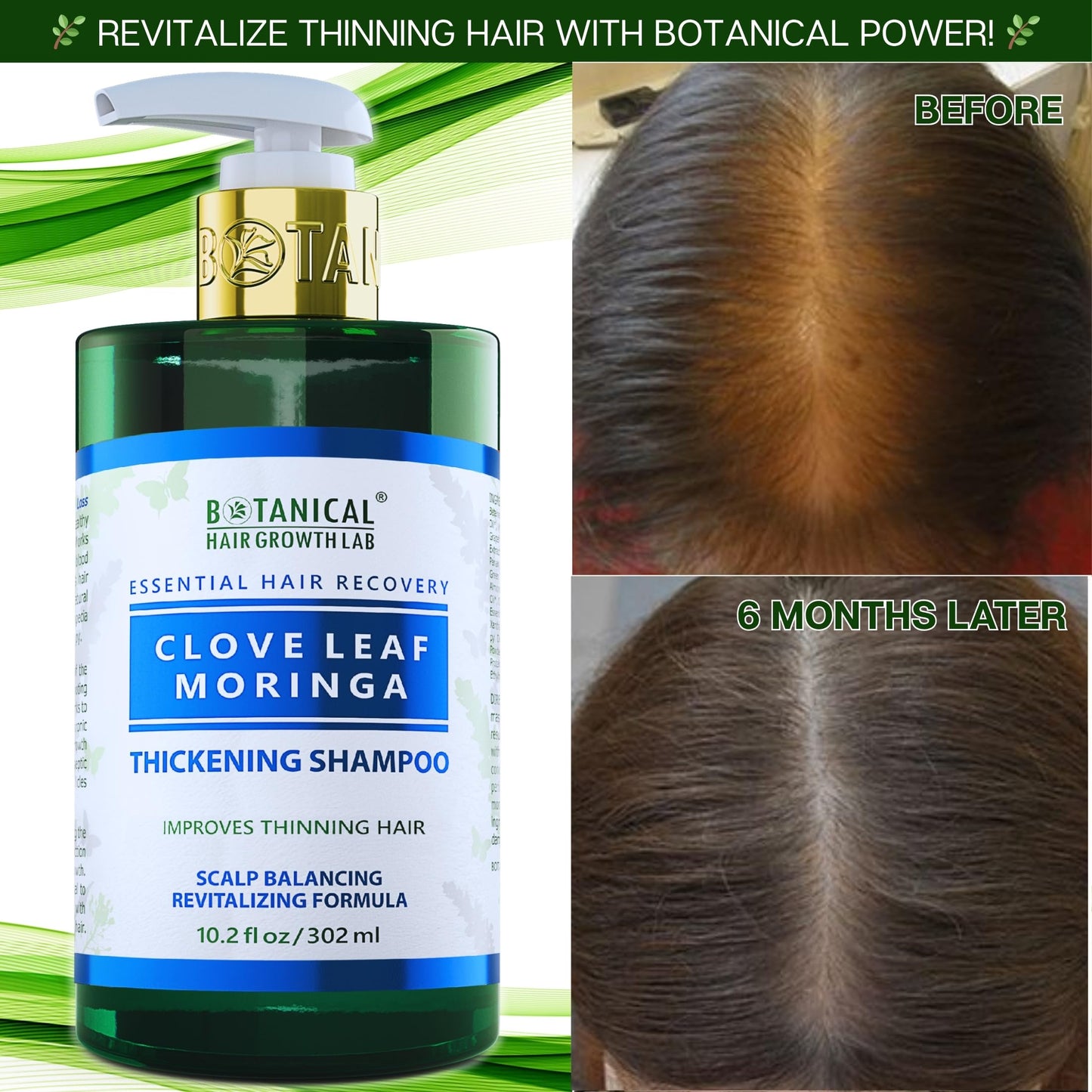 Botanical Hair Growth Shampoo for Hair Thickening Anti-Thinning Scalp Stimulating Natural Anti-Hair Loss Therapy For Women & Men 10.2 Fl Oz