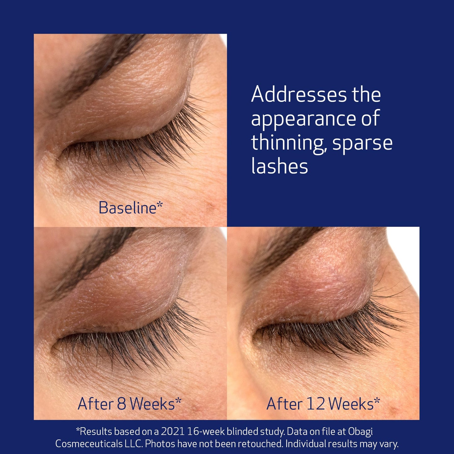 Obagi Nu-Cil Eyelash Enhancing Serum – Nourishing Lash Serum with Biotin for Thicker & More Defined-Looking Lashes – 0.1 oz