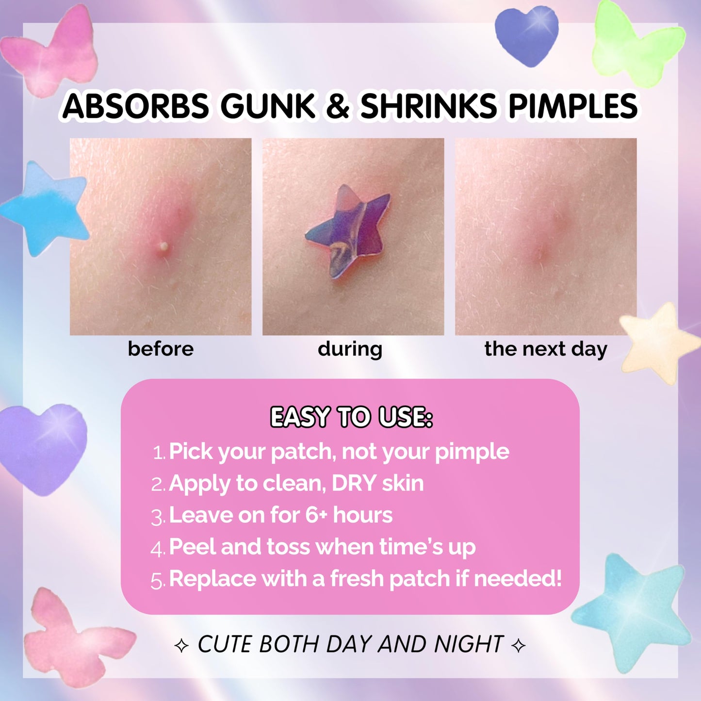 Sparkle Beauty Labs Heal & Conceal Holographic Cute Pimple Patch Bundle (240 Count) Iridescent Star, Heart & Butterfly Shaped Hydrocolloid Acne Patches for Face, Fun Hydrocolloid Zit Stickers