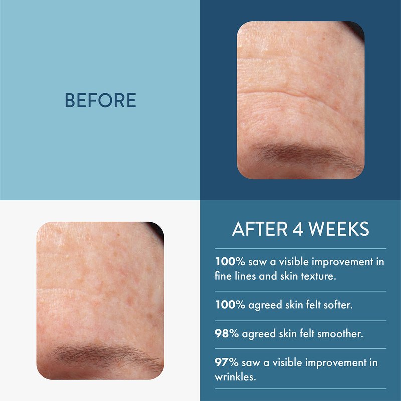 Lancer Skincare The Method Intro Kit, 3-Step Facial Exfoliator, Cleanser, and Moisturizer Kit for Oily or Congested Skin