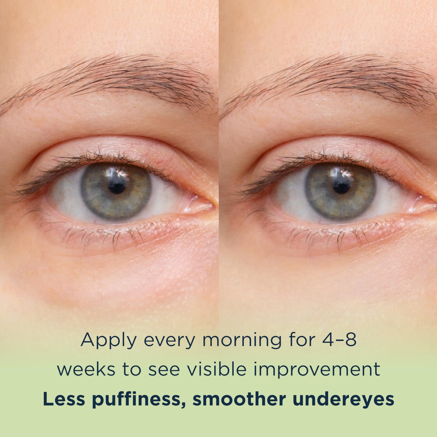 MATKAS Korean Vitamin C Under Eye Brightener for Dark Circles 0.5 Floz.